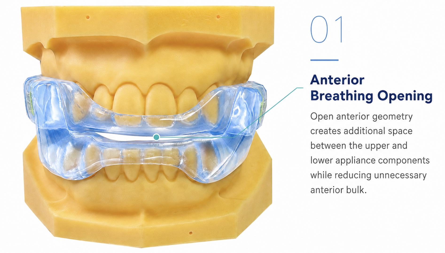 Master Sleep 10™ appliance — anterior breathing opening