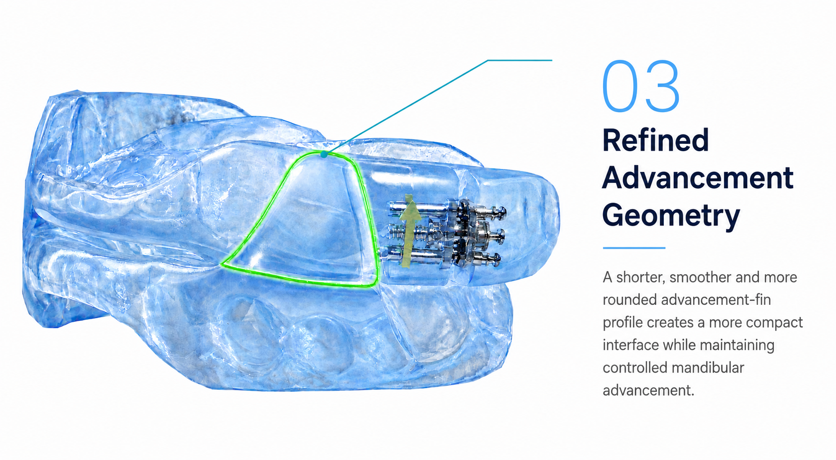 Master Sleep 10™ appliance — refined advancement geometry