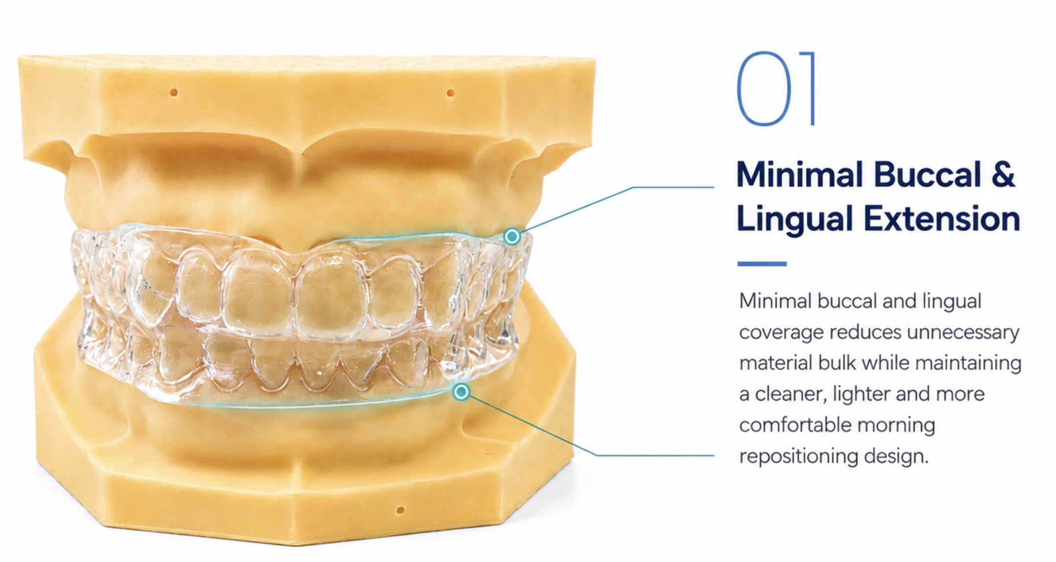 Master Sleep 10™ Morning Repositioner — minimal buccal and lingual extension