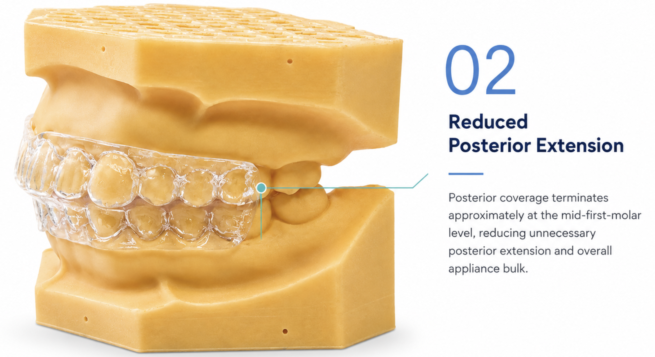 Master Sleep 10™ Morning Repositioner — reduced posterior extension