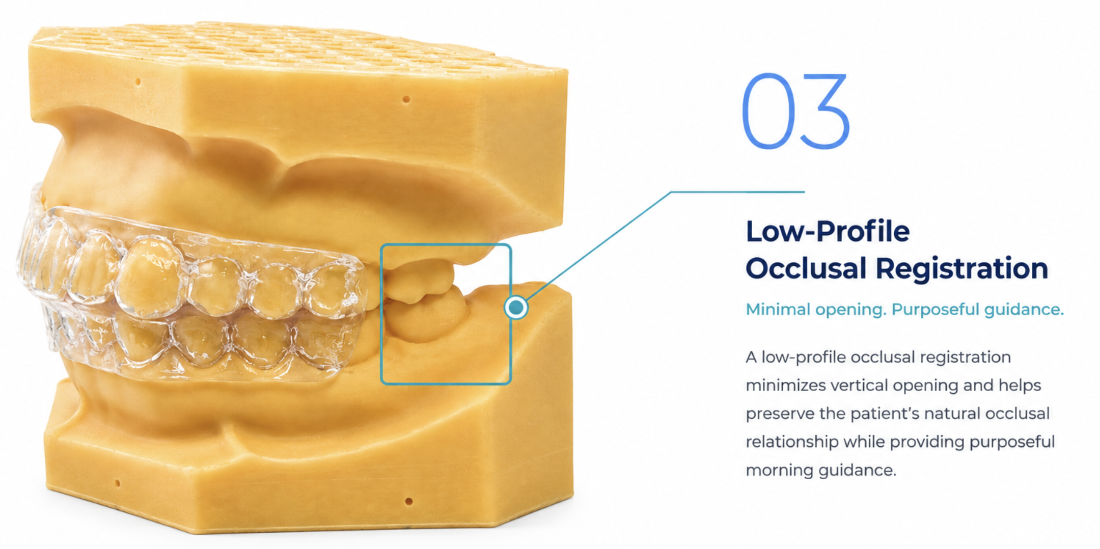 Master Sleep 10™ Morning Repositioner — low-profile occlusal registration